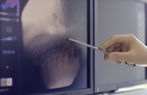 Sports Medicine Regenerative Injections: A Patient’s Guide Polaris Spine & Neurosurgery Center